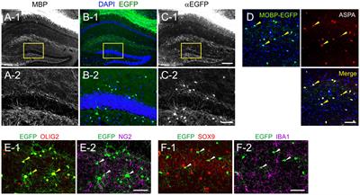 Age and Alzheimer’s Disease-Related Oligodendrocyte Changes in Hippocampal Subregions